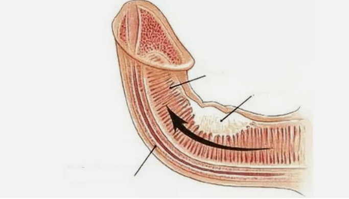 Eliminate vein flow